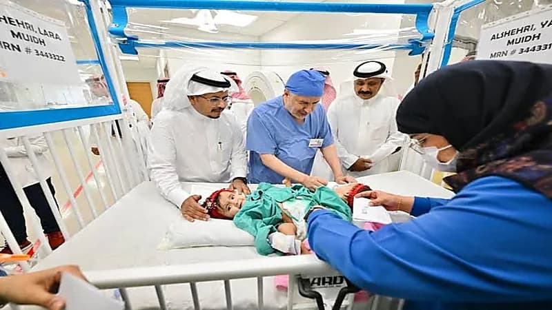 نجاح المرحلة الأولى من عملية فصل التوأم السيامي يارا ولارا