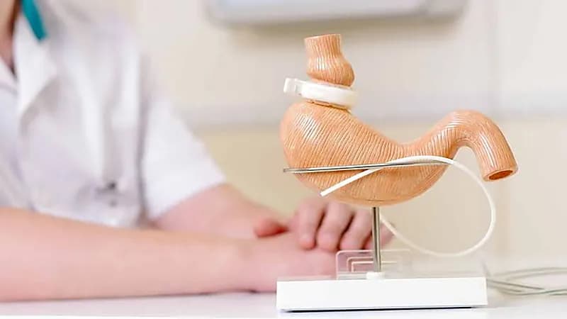 خالد النمر: عمليات ربط المعدة تضعف عضلة القلب