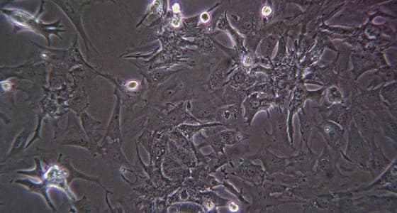 بالصور.. الصدفة تؤدي لاكتشاف كائن الـ " دومينيكا إماراتيا " بأبوظبي