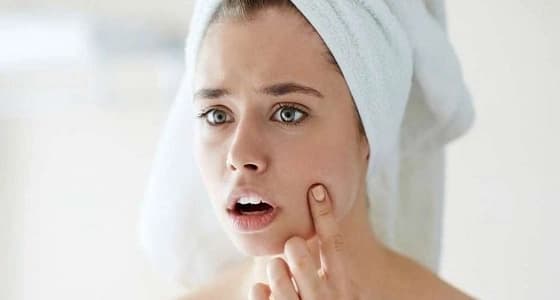 وصفة سحرية للتخلص من الرؤوس السوداء