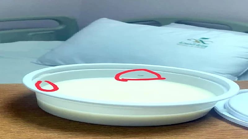 شكوى ضد مستشفى أطفال بالطائف بسبب وجبة حساء بالديدان