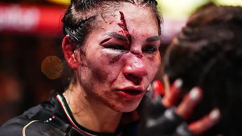 ملاكمة مكسيكية تتلقى إصابة خطيرة في نزال