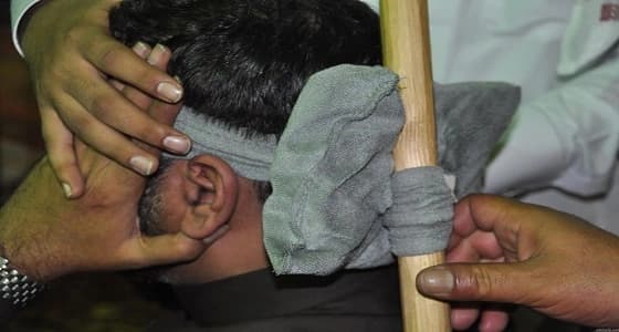 " الوطني للطب البديل " : العلاج بشد الرأس غير مثبت علميا