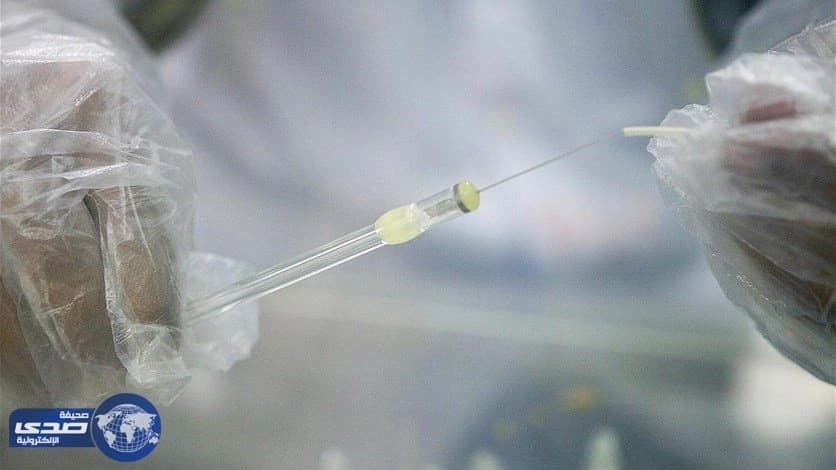 أسكتلندي يٌنجب توأم من حيواناته المنوية المٌجمده لمدة عامين