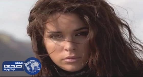 بالصور.. ملكة جمال إيطاليا تكشف عن وجهها المشوه