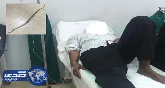 لدغة ثعبان تجبر طبيب مقيم بقرية دراويش للسفر 200 كم لإسعافه