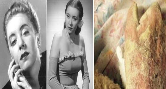 بالصور.. الجرب يحول نجمة تلفزيونية ساحرة الجمال إلى جسد أسود متعفن