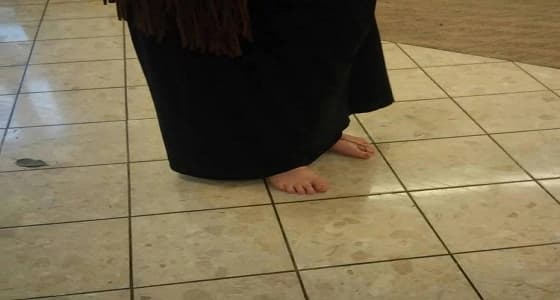 فتاة تقضي 3 سنوات حافية