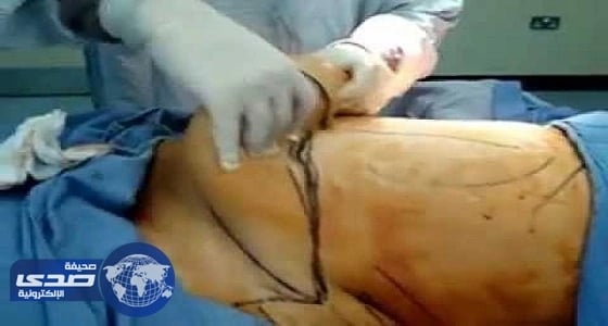 كاتبة سعودية تكشف: أطباء تجميل يبتزون الفتيات والتخفيض مقابل التصوير