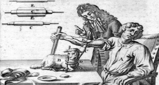 أول عملية في التاريخ..  نقل دم خروف إلى إنسان في القرن الـ17