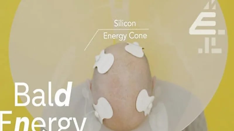 حقيقة الأخبار المتداولة بشأن توليد الكهرباء من " صلعة الرجال"