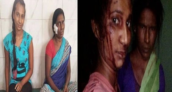 مشاجرة عنيفة بين فتاة ونمر لحماية ماعزها