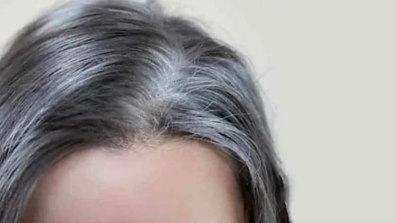 4 علاجات منزلية للتخلص من الشيب