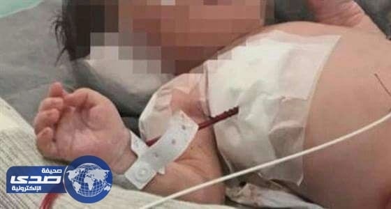 ⁠⁠⁠⁠⁠العناية الإلهية تنقذ جنين تلقى رصاصة وهو في رحم أمه