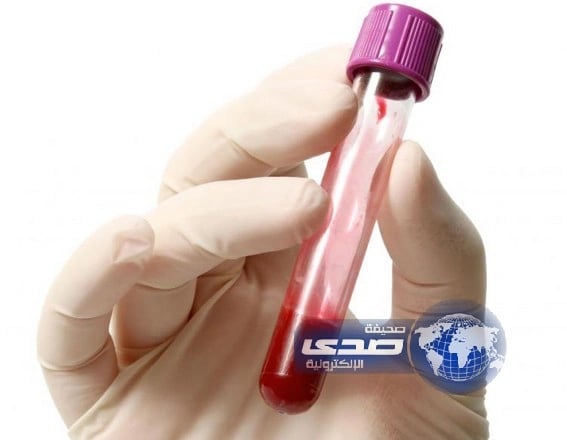 فحص للدم يحدد كم تبقى من العمر