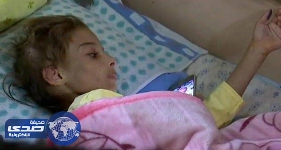 سيدة تعذب ابنتها بقلع الشعر ونزع الأظافر