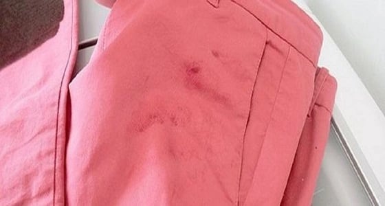 حيلة مذهلة للتخلص من بقع الدهون العالقة بالملابس