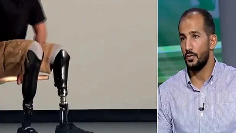 مؤسس جمعية "بتور": نساعد في توفير الأطراف الصناعية لذوي الحاجة