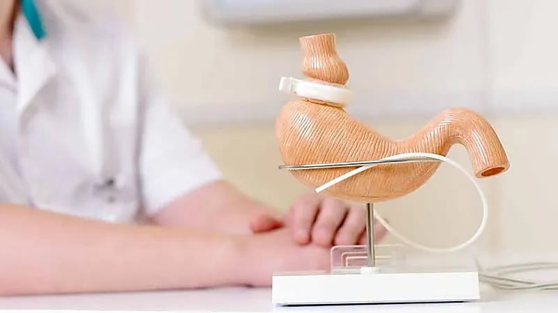 خالد النمر: عمليات ربط المعدة تضعف عضلة القلب