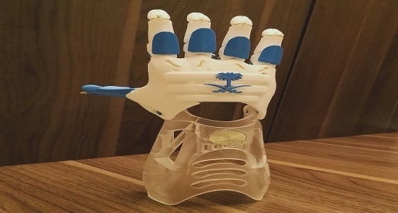 بالصور..طالب يصمم أول طرف صناعي بتقنية ثلاثية الأبعاد