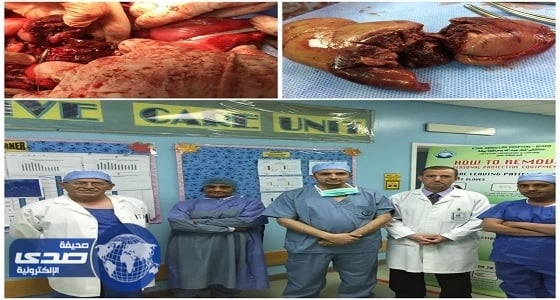 إنقاذ حياة عشريني تعرض لطلق ناري بمستشفى الملك عبدالله ببيشة