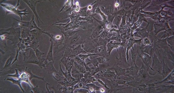 بالصور.. الصدفة تؤدي لاكتشاف كائن الـ " دومينيكا إماراتيا " بأبوظبي
