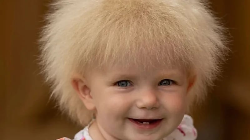 رضيعة تثير الجدل لشدة تشبهها برئيس الحكومة البريطاني المستقيل