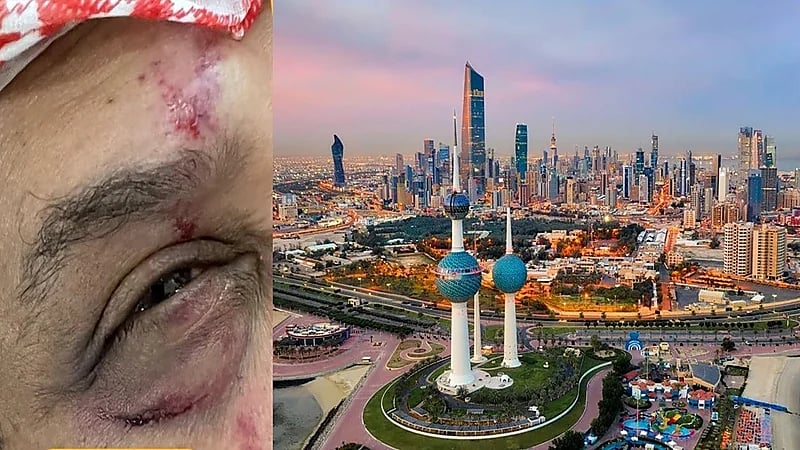 كويتيون يتهمون موظفي مركز صحي بضرب والدهم المسن