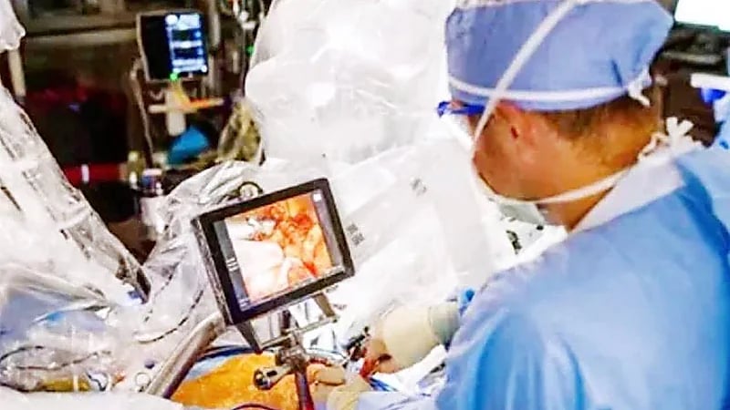 إجراء أول عملية استبدال صمام قلب دون فتح الصدر