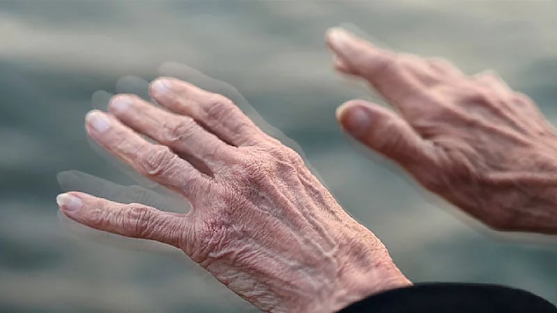 استشاري يوضح أعراض الشلل الرعاش