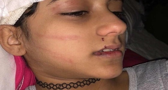 والد " مايا " ضحية النمر بجدة يكشف تطور جديد في قضية ابنته