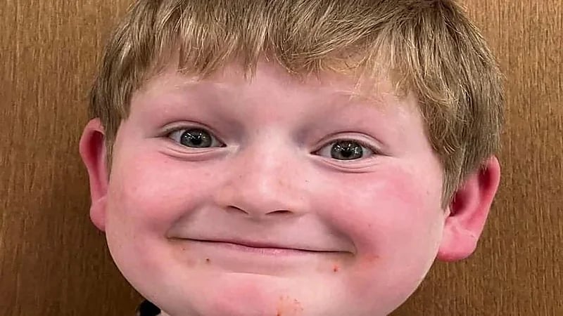 3 كلاب ضالة هاجموا طفلاً ومزقوا فروة رأسه أثناء ركوبه الدراجة