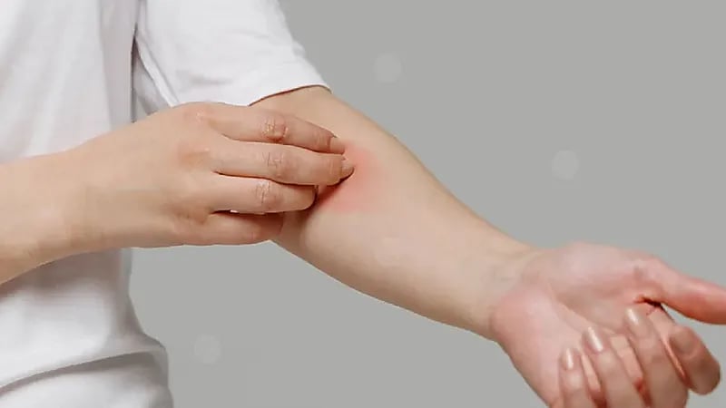 طبيبة: 20% من المواطنين يعانون من حساسية الأطعمة .. فيديو