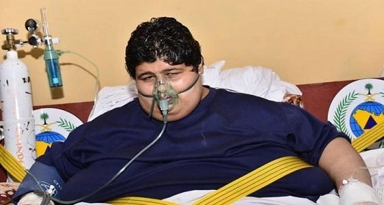 شاهد.. تغير خطير في حالة خالد شاعري مريض السمنة بعد 4 سنوات