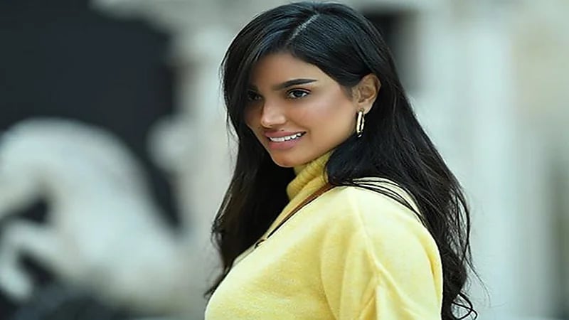 أودي الزبن تظهر بشفاه مشوهة بعد إزالة الفيلر