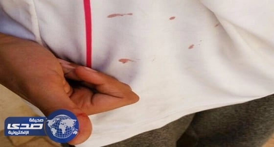 اعتداء معلم على طالب بسبب حضوره للمدرسة
