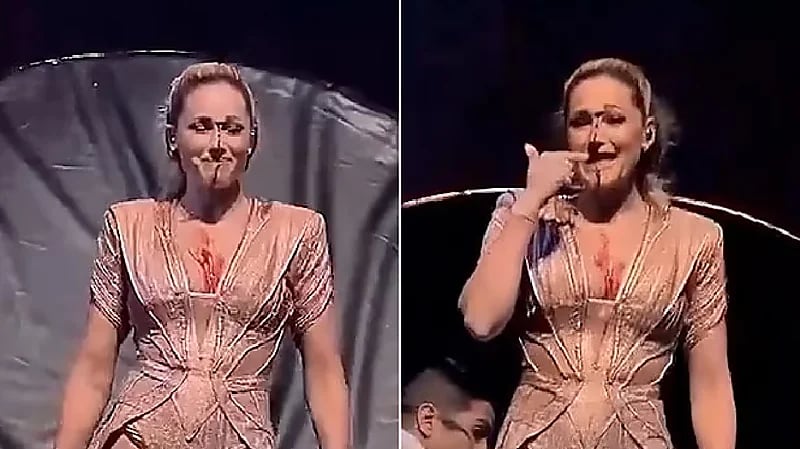 سقوط مروع لفنانة ألمانية أثناء عرض مسرحي.. صور