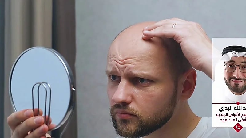 استشارى: الثوم يضاعف مشكلة الثعلبة ولا يوصي باستخدامه إطلاقا ..فيديو