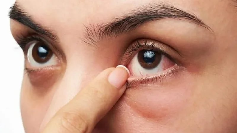 6 نصائح للوقاية من جفاف العين .. فيديو