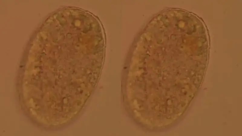 ‎أطباء يكتشفون ديدانًا مماصةً للدماء في أمعاء امرأة