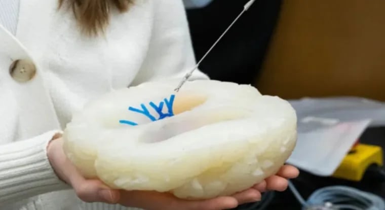 روبوتات دقيقة تحقق 76% نجاحًا في جراحات الدماغ بدون مشرط .. صور