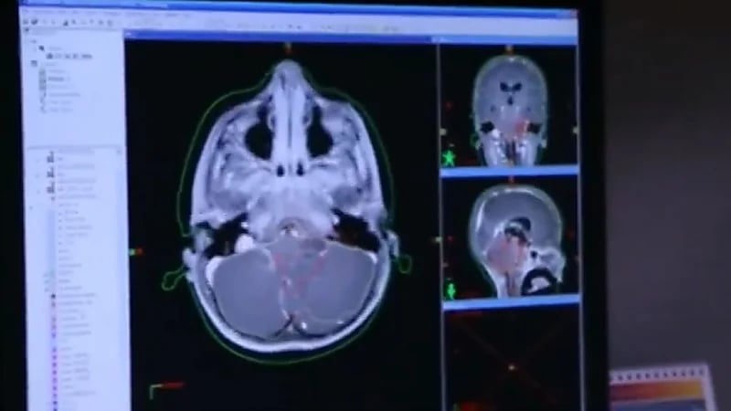 استشاري : نسبة النجاة من سرطان البنكرياس 30% بسبب شراسته .. فيديو
