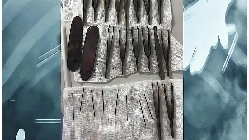 شاب يبتلع 24 ملقط شعر وإبرة.. صور