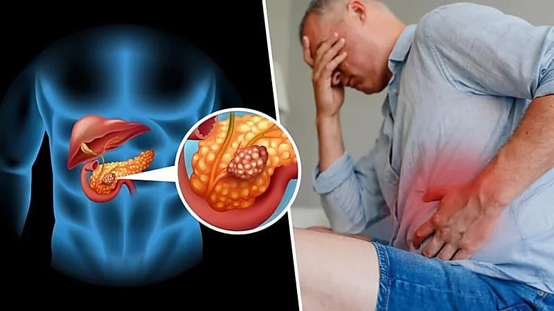 علامات تكشف احتمالية الإصابة بسرطان البنكرياس