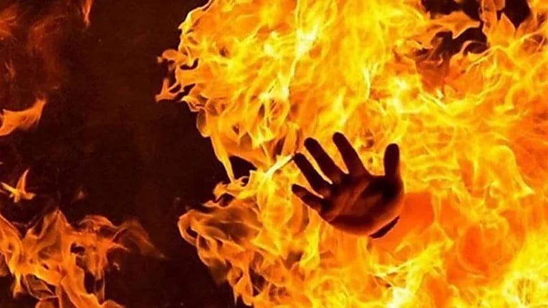 زوج يشعل النيران في زوجته بسبب خلافات بينها