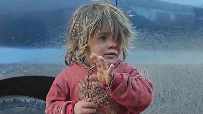 والد الطفلة التي هزت صورتها العالم يكشف حقيقة تعنيفها وموتها جوعا