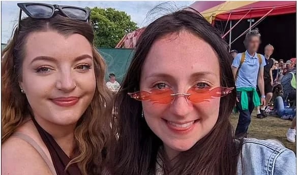 بالصور.. تضاعف وجه فتاة بسبب نسيان واقي الشمس