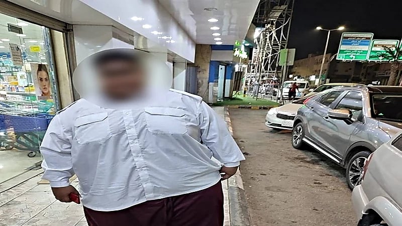 حارس أمن يتيم يعاني من السمنة المفرطة ويناشد علاجه