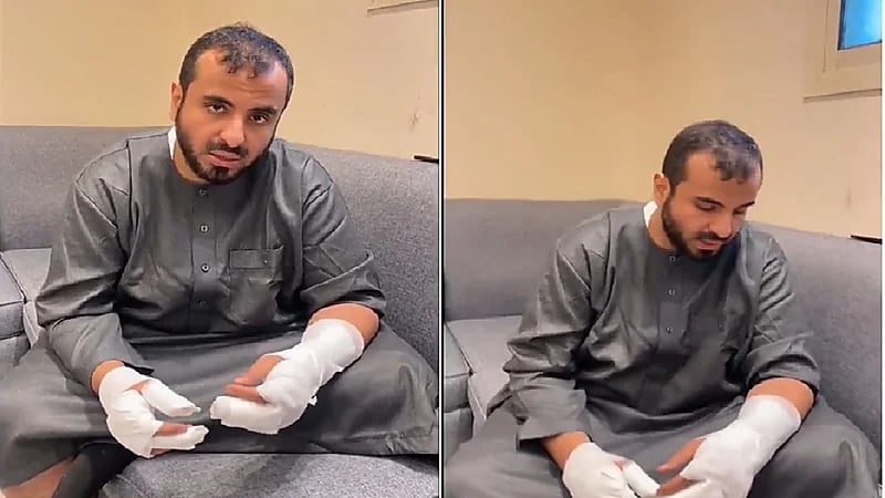 بالفيديو.. مفسر الأحلام محمد عجب يتعرض لحريق ويعلق: لحيتي راحت