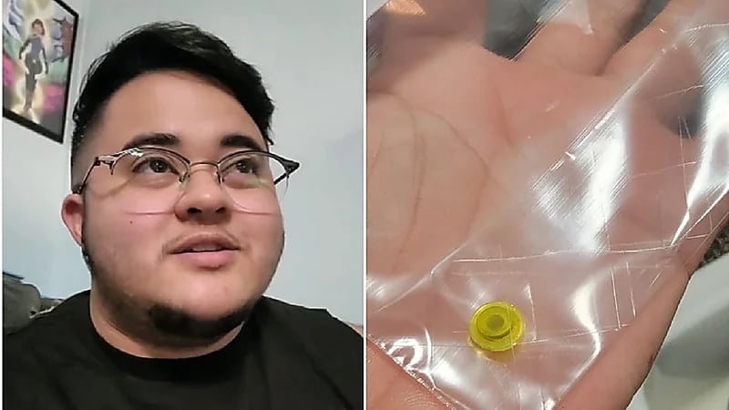 بعد 25 عاماً .. العثور على جسم غريب داخل أنف شاب